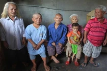 Đời không như cổ tích của gia đình... lùn nhất Việt Nam