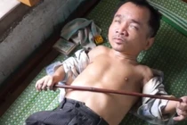 Cuộc sống khốn khó của gia đình “dị nhân” cao 60cm