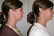 10 trào lưu làm đẹp quái đản không ai ngờ tới