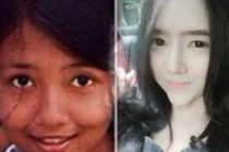 Cô gái vừa đen vừa xấu hóa hot girl nhờ "dao kéo"