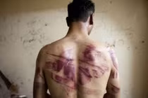 Lời kể sốc của người bị xâm hại tình dục ở nhà tù Syria