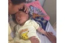 Ăn nhầm hóa chất, bé trai 3 tuổi bỏng thực quản dạ dày