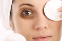 Những điều chưa biết về bệnh thâm quầng mắt