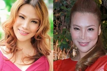 Sao Việt hứng chịu hậu quả của phẫu thuật thẩm mỹ