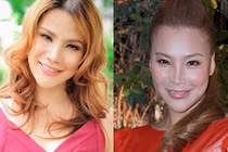 Sao Việt hứng chịu hậu quả của phẫu thuật thẩm mỹ