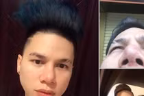 Phẫu thuật thẩm mỹ hỏng quý ông nếm trái đắng nghìn đô