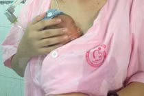 Cứu 2 bé sinh non nặng dưới 800 gram kèm suy hô hấp nặng