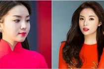 Hành trình “biến đổi” cằm vuông thành cằm nhọn của Kỳ Duyên 