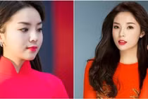 Hành trình “biến đổi” cằm vuông thành cằm nhọn của Kỳ Duyên 