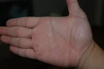 9 vị trí nốt ruồi mang lại phúc lộc cả đời cho chủ nhân