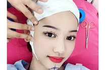 Thúy Vi tự tử vì phẫu thuật thẩm mỹ thất bại? 