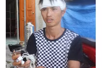 Bé 8 tuổi cắt bỏ tay, nguyên nhân khiến ai cũng phải giật mình