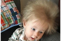 Cậu bé có mái tóc dài kỳ lạ ngay từ khi còn trong bụng mẹ