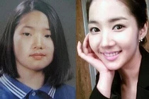 Top 8 “Đệ nhất mỹ nhân dao kéo” của xứ sở Kim chi