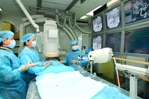 Phương pháp trị di căn gan từ ung thư đại trực tràng