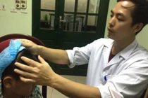 Phẫu thuật thành công bệnh nhân bị động kinh cơn cười