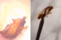 Chết khiếp bác sĩ gắp gián "ngoe nguẩy" khỏi tai người phụ nữ