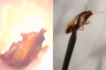 Chết khiếp bác sĩ gắp gián "ngoe nguẩy" khỏi tai người phụ nữ