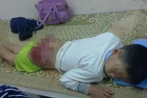 Những vụ cha mẹ đánh con khiến dư luận phẫn nộ