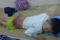 Những vụ cha mẹ đánh con khiến dư luận phẫn nộ