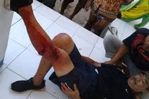 Đắng ngắt cái giá phải trả khi đến gần rồng Komodo