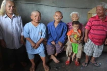 Kỳ lạ gia đình lùn nhất Việt Nam 4 đời không thoát "lời nguyền"