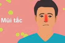 Xì mũi sai cách và những biến chứng khó lường