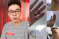 Ca sĩ Đông Hùng bị chém rách tay bởi chủ nợ của mẹ?