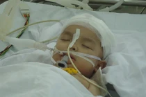 Hy hữu: Bé trai chấn thương sọ não vì ti vi rơi vào đầu