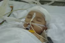 Hy hữu: Bé trai chấn thương sọ não vì ti vi rơi vào đầu