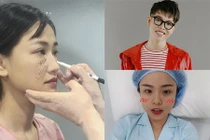 Loạt sao Việt không ngại công khai phẫu thuật thẩm mỹ