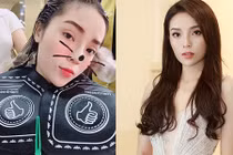 Kỳ Duyên lại vướng nghi vấn phẫu thuật thẩm mỹ vì mắt sưng húp 