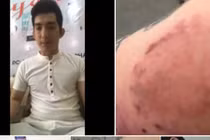 Bảo Duy công khai ảnh bị Phi Thanh Vân dùng guốc đánh