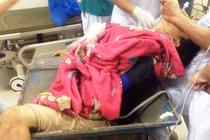 Tai nạn lao động nghiêm trọng, một thanh niên bị nghiền nát chân