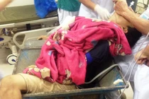 Tai nạn lao động nghiêm trọng, một thanh niên bị nghiền nát chân