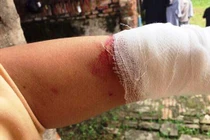 Không có chuyện CSGT Hải Dương đánh người vi phạm rách môi