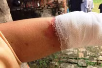 Không có chuyện CSGT Hải Dương đánh người vi phạm rách môi