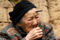 Những ca thừa bộ phận cơ thể kỳ quặc trên thế giới 