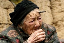 Những ca thừa bộ phận cơ thể kỳ quặc trên thế giới 