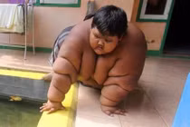 5 kỷ lục béo phì và tiểu đường ở trẻ em