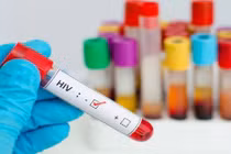 Cưỡng dâm truyền bệnh HIV, xử phạt ra sao?