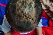 Bạo hành con thậm tệ, không thể tin nổi họ là bố mẹ nạn nhân