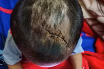 Bạo hành con thậm tệ, không thể tin nổi họ là bố mẹ nạn nhân