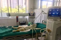 Vụ tưới xăng đốt 5 người trong nhà ở Sơn La: Bé 3 tuổi đã tử vong