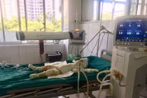 Vụ tưới xăng đốt 5 người trong nhà ở Sơn La: Bé 3 tuổi đã tử vong