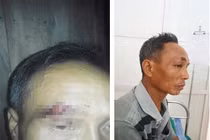 Công an bị "tố" vào nhà đánh người: Đại úy nói chỉ là "chuyện gia đình"