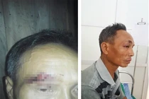 Công an bị "tố" vào nhà đánh người: Đại úy nói chỉ là "chuyện gia đình"