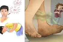 Video: 15 mẹo vặt sức khỏe độc đáo và hiệu quả 