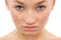 10 việc làm hàng ngày đang hủy hoại làn da của bạn