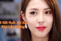 Video: Những nốt ruồi “ám quẻ” nên xóa nếu không muốn gánh họa cả đời